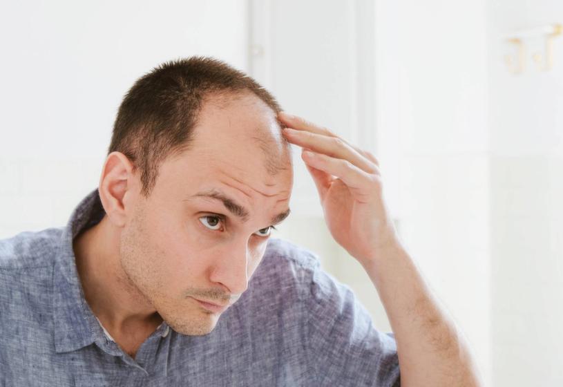 Tricopigmentazione per cicatrici: vantaggi e svantaggi