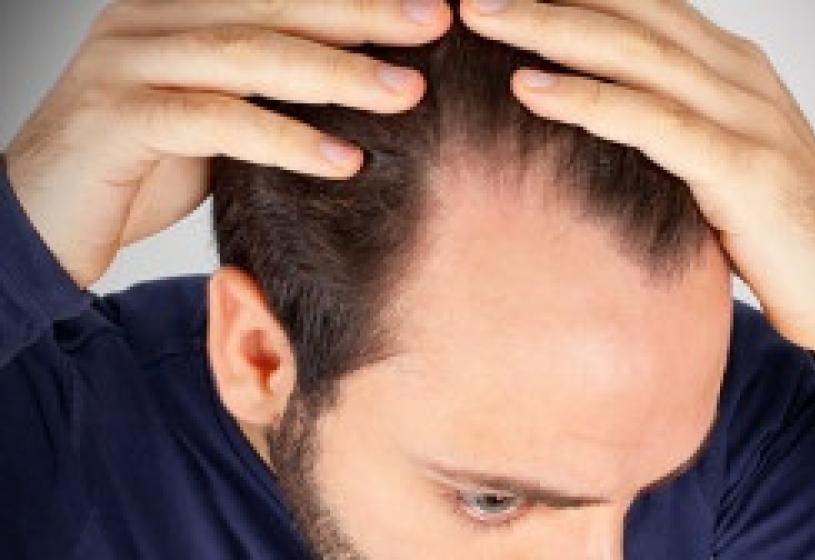 Curare i capelli secchi: la prevenzione prima di tutto