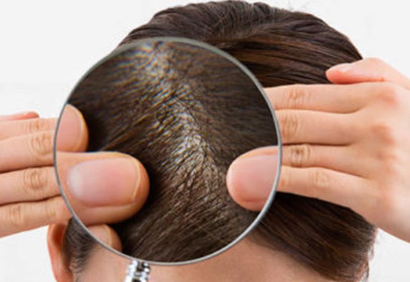 La polvere per capelli fa male? 9 cose che forse non sai