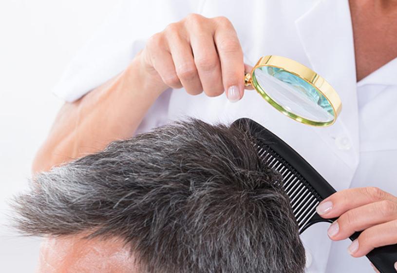 Caduta dei capelli: meglio il dermatologo o il tricologo?