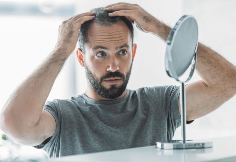 7 consigli per la cura della tua alopecia da stress
