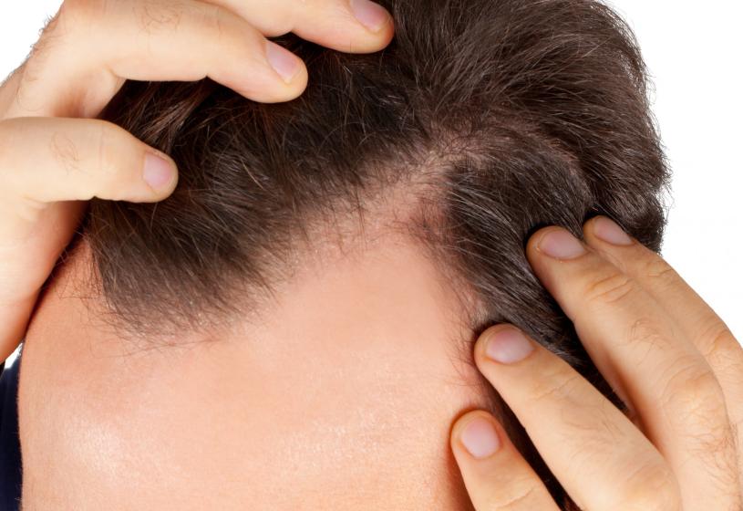 Stempiatura dei capelli: 7 cose che puoi fare subito